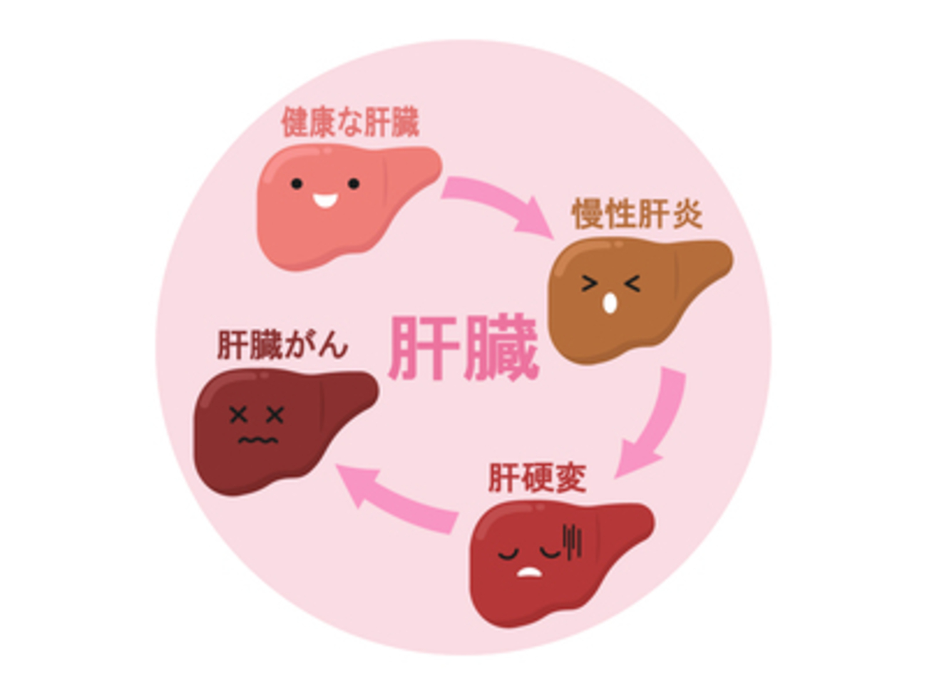 肝硬変に関する雑学 - 面白雑学・豆知識ブログ！