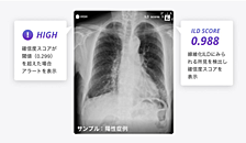 間質性肺炎を検出するAIを開発し、その有効性を検証した研究を論文化しました