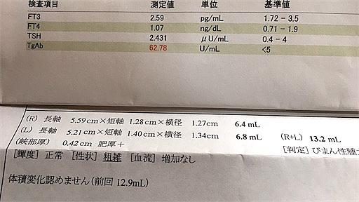 橋本病とは サイエンスの人気 最新記事を集めました はてな