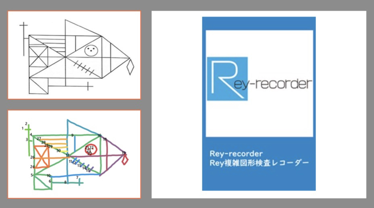 レザック神経心理学的検査集成 創造出版
