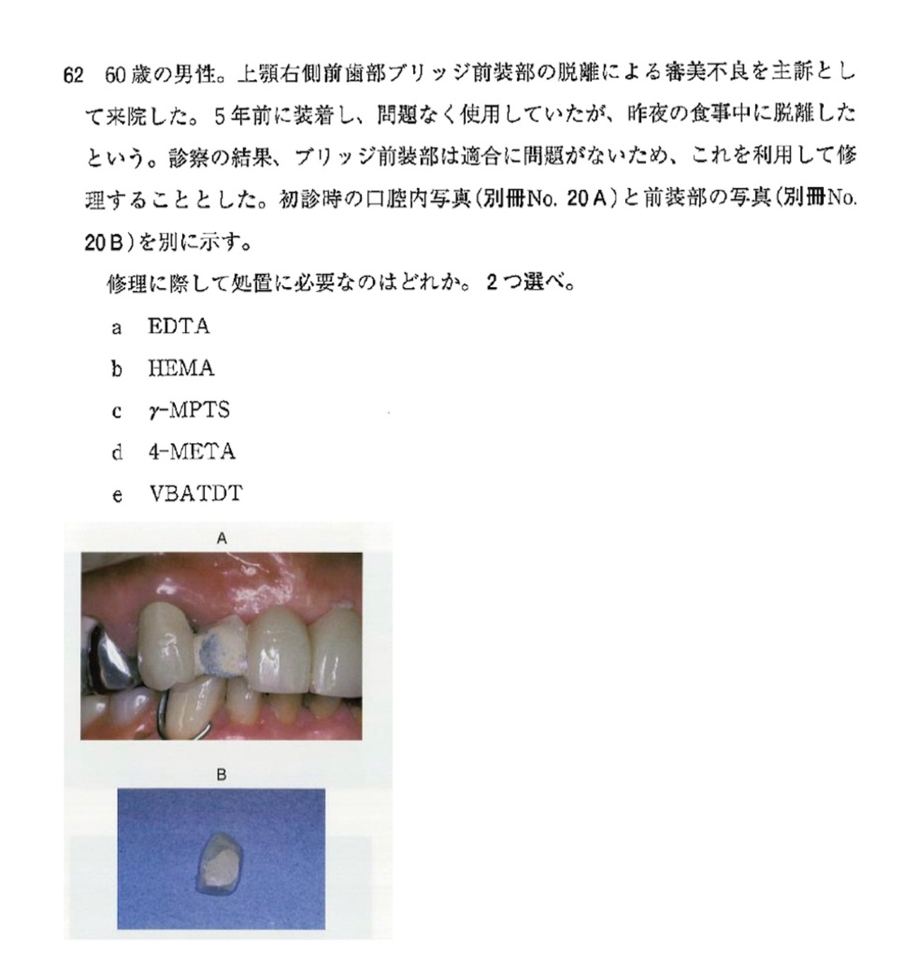 歯の組織学、フローチャートによる歯冠修復・補綴物の作製 フローチャートによる歯冠修復・補綴物の作製 ―歯科理工学理解の