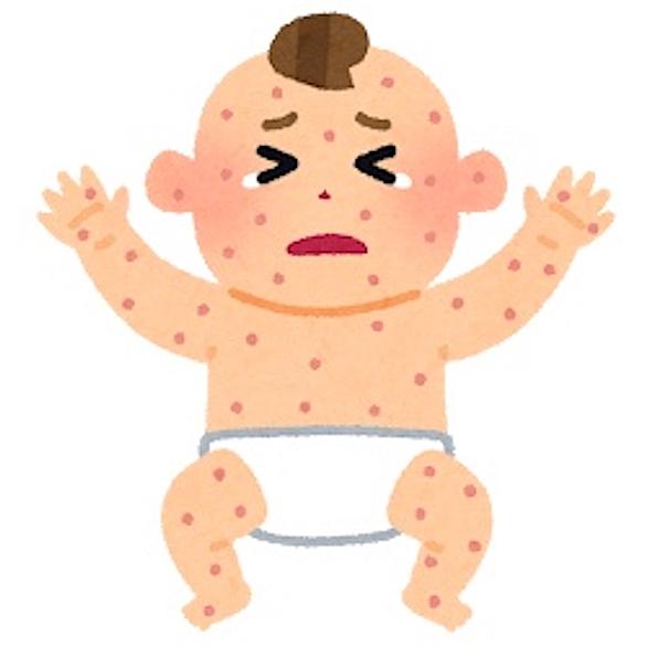 キンダベート プロペトとは 人気 最新記事を集めました はてな