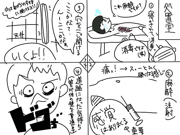 気胸とは サイエンスの人気 最新記事を集めました はてな