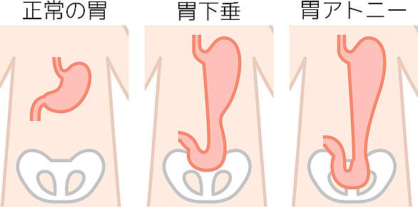 胃下垂とは サイエンスの人気 最新記事を集めました はてな