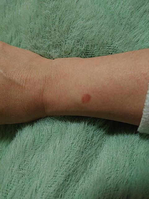 根性焼きとは 一般の人気 最新記事を集めました はてな 根性焼きとは 一般の人気 最新記事を集めました はてな