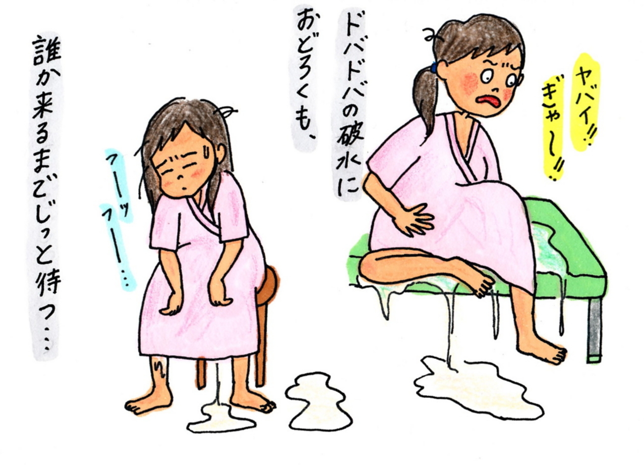 破水 人工破水から一気に陣痛！ところが夫は外出中、ナースコール連打するも誰も来ない〜？！ - みんなの体験記【妊娠・出産・育児】