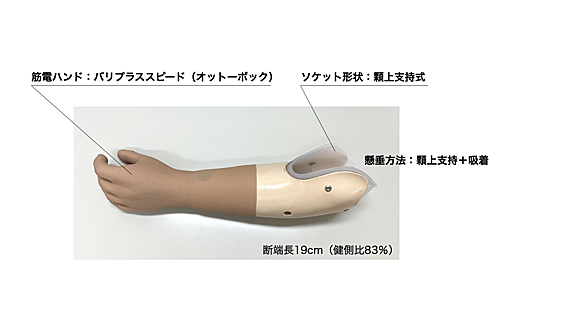 筋電義手とは 一般の人気 最新記事を集めました はてな