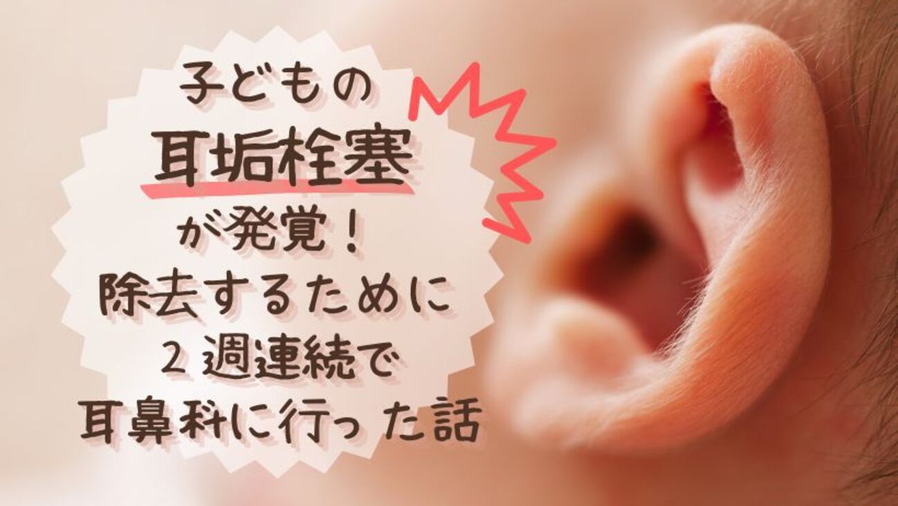 子供 耳垢 栓塞