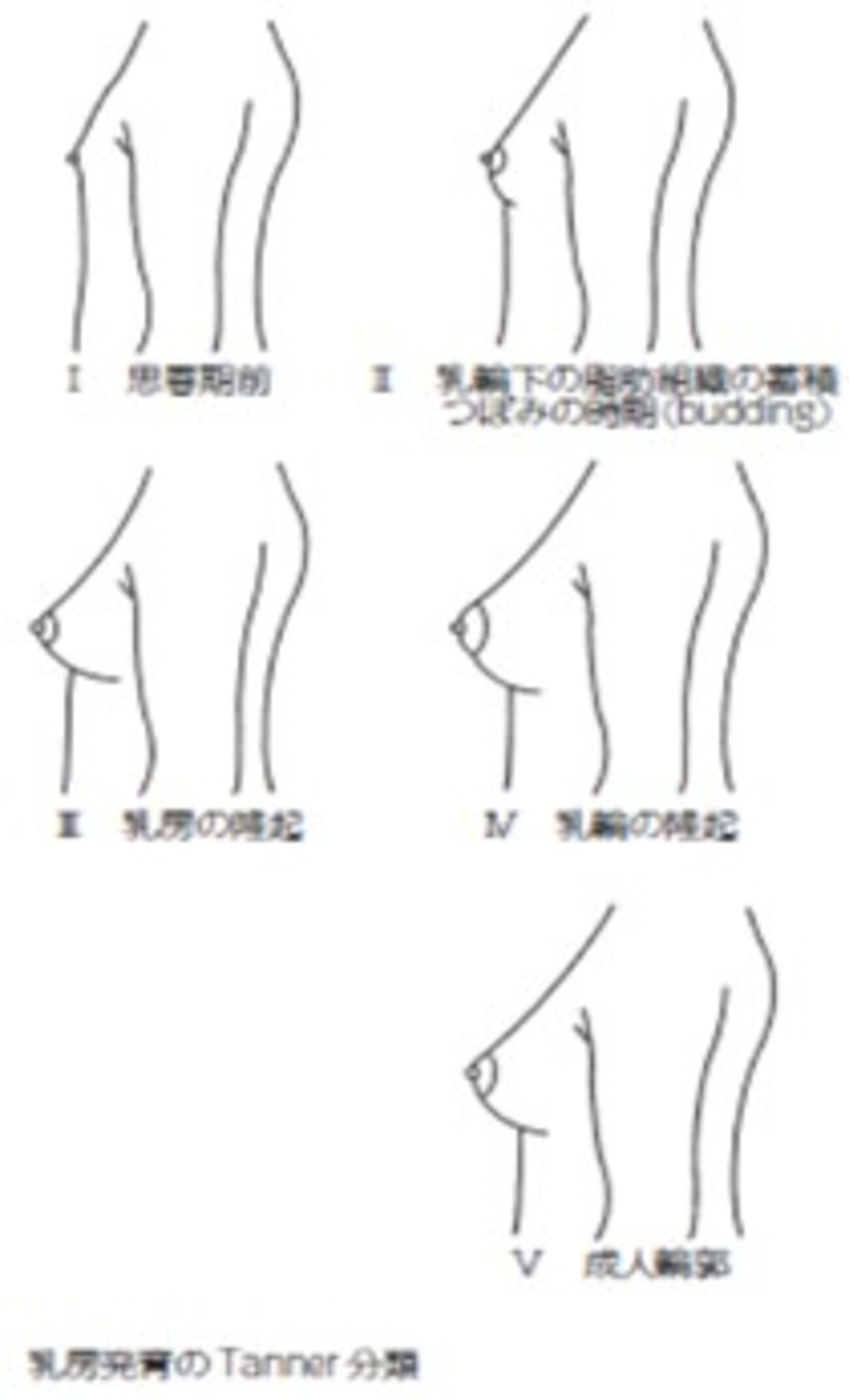 思春期前の胸 保育士からの質問 「片方の胸がふくらんでますけど大丈夫でしょうか？」 - チームまなべのブログ