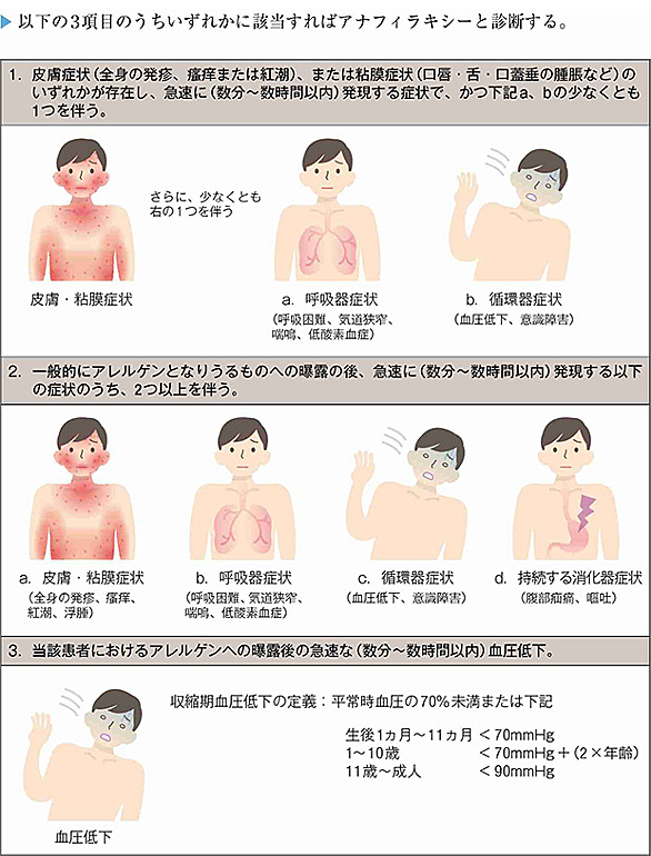 エピペンとは サイエンスの人気 最新記事を集めました はてな エピペンとは サイエンスの人気 最新記事を集めました はてな