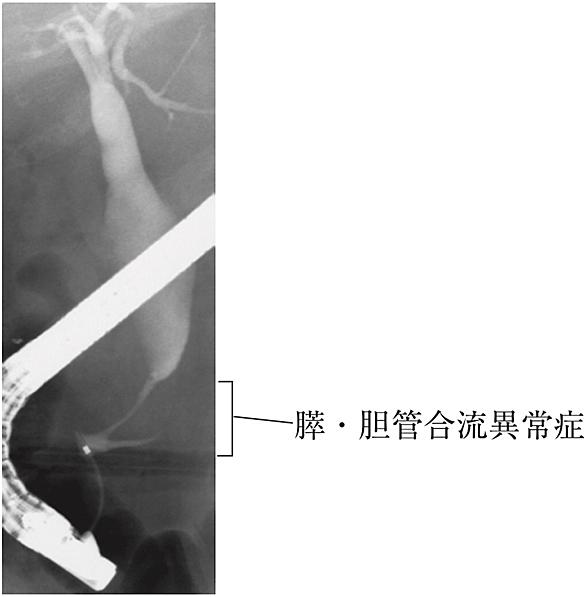 半陰陽とは 一般の人気 最新記事を集めました はてな 半陰陽とは 一般の人気 最新記事を集めました はてな