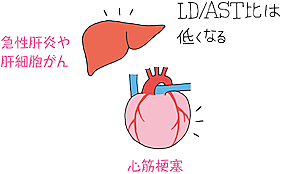Ldhとは 一般の人気 最新記事を集めました はてな