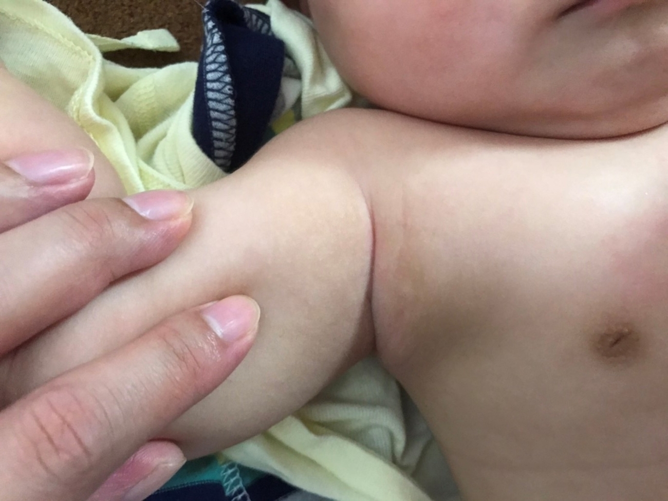乳首  アップ 副乳は遺伝しやすい！赤ちゃんの脇に副乳を見つけた話 - 子育て記録あれやこれ