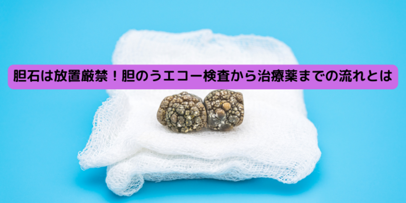 胆石は放置厳禁!胆のうエコー検査から治療薬までの流れとは - 内臓の素晴らしき世界