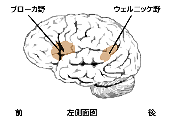 ウェルニッケ失語とは サイエンスの人気 最新記事を集めました はてな