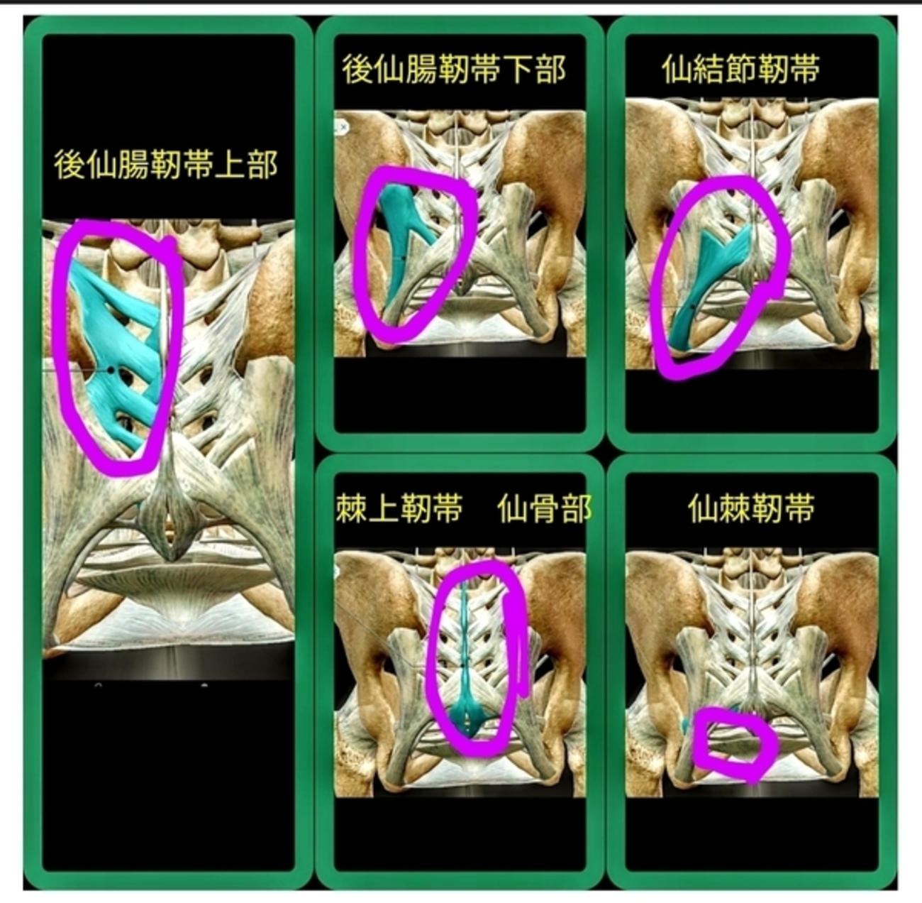 仙骨の背面にある靭帯のリリースについての考察と懺悔 - bodywise’s diary