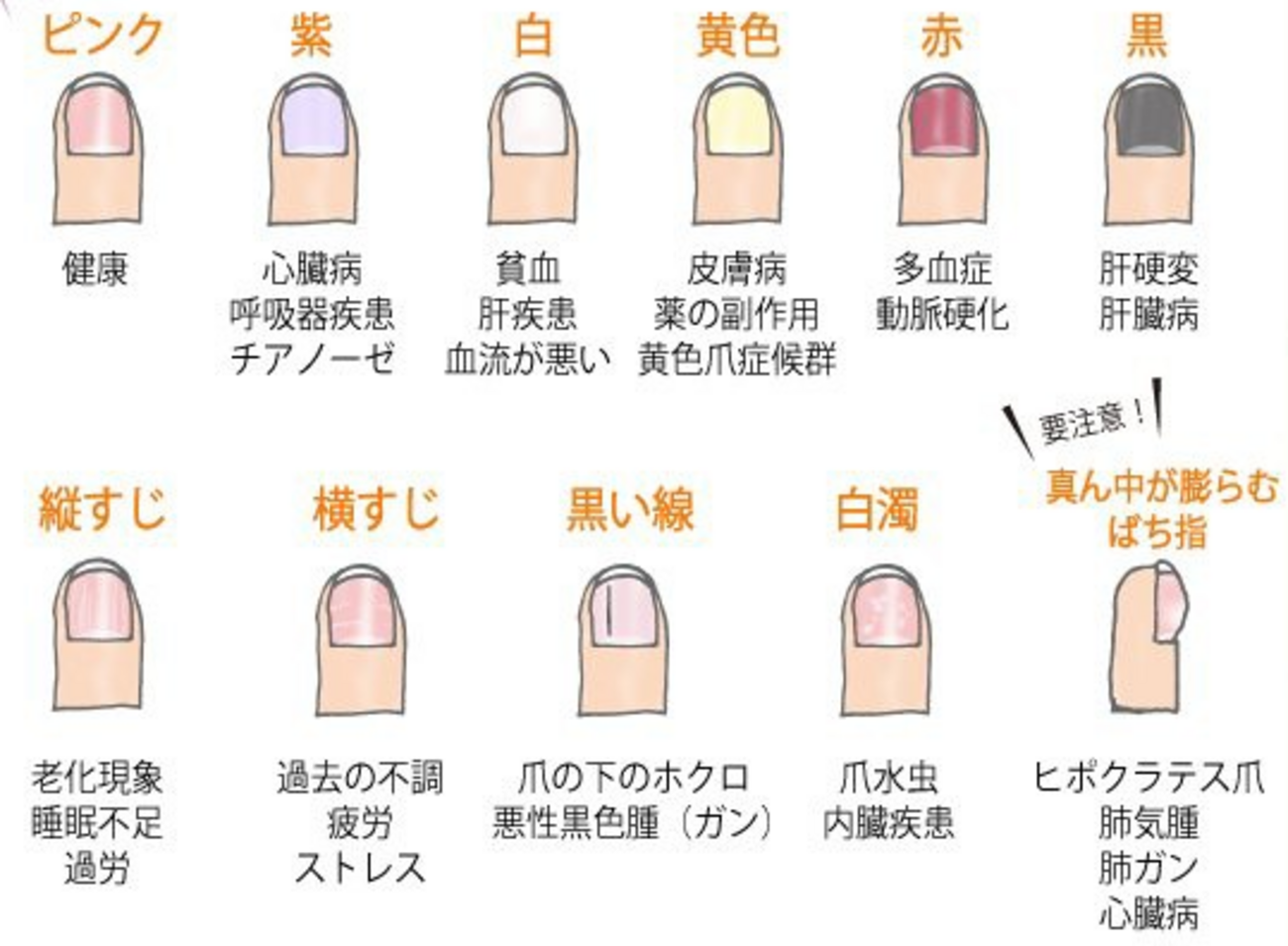 爪で分かる健康サイン!形と色の変化から病気を早期発見するチェック一覧 - harunori_model