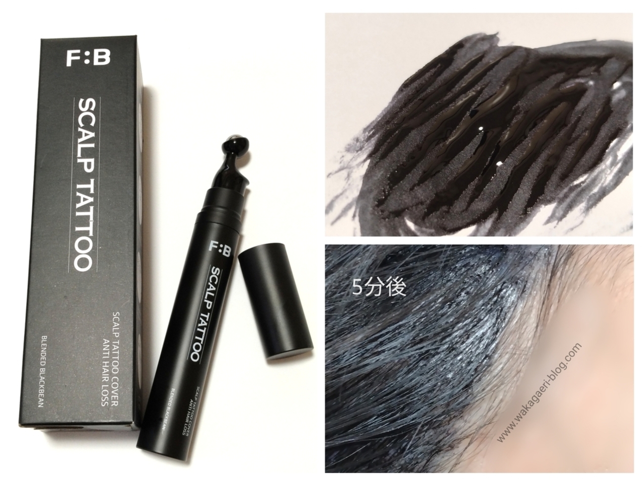 口コミ】FORBEAUT(フォービュート)スカルプタトゥーで頭皮ティント 