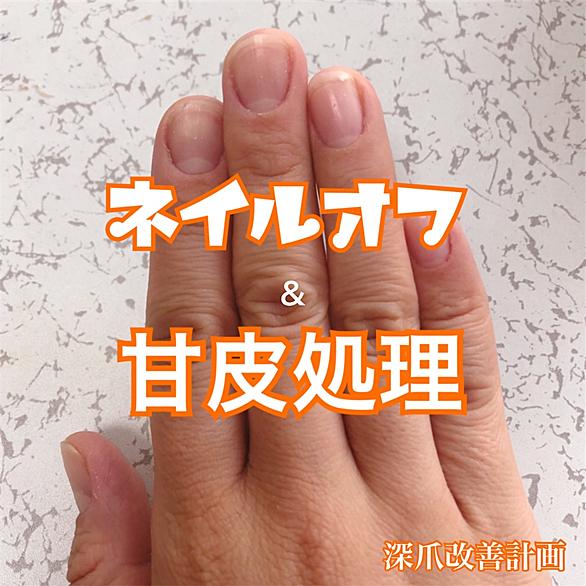 深爪とは 一般の人気 最新記事を集めました はてな 深爪とは 一般の人気 最新記事を集めました はてな