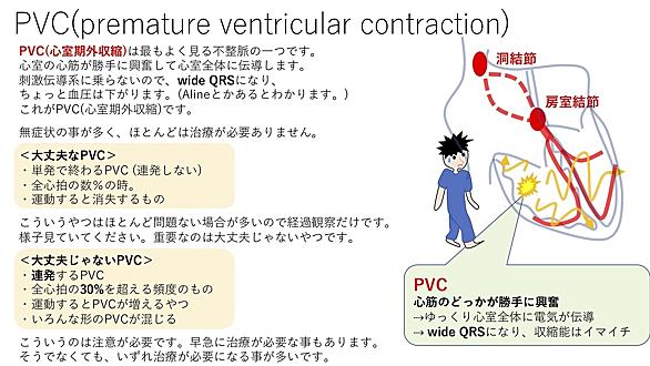 期外収縮とは サイエンスの人気・最新記事を集めました はてな