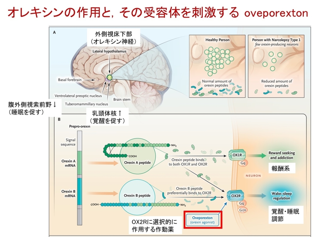 ナルコレプシーに対するオレキシン作動薬の夜明け - Neurology 興味を