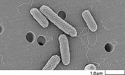 緑膿菌とは サイエンスの人気 最新記事を集めました はてな