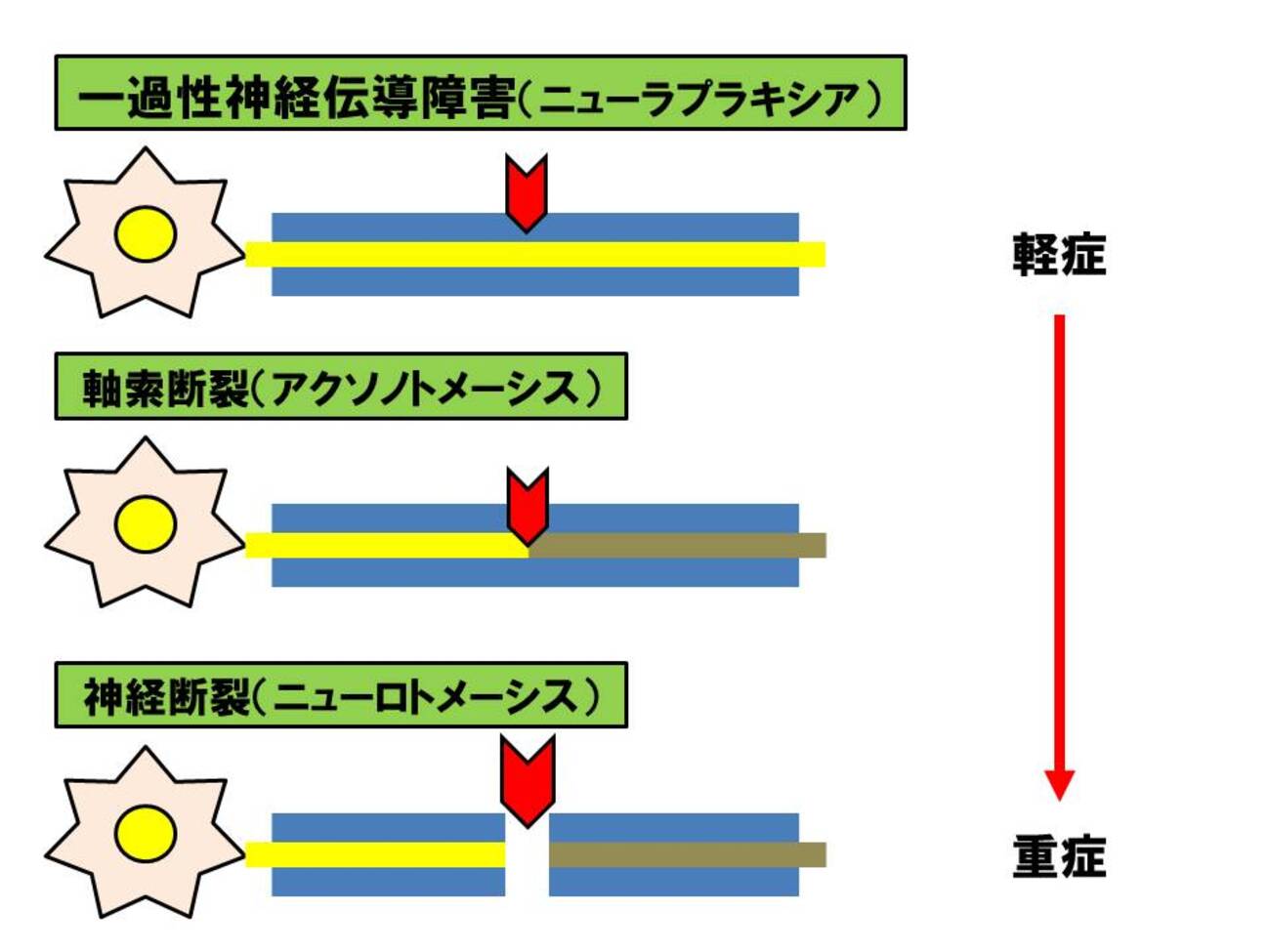 末梢神経マニピュレーション 末梢神経マニピュレーション - メルカリ
