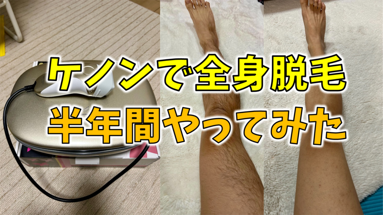 脱毛】家庭用脱毛器ケノンで半年間、全身脱毛をしてみた結果 