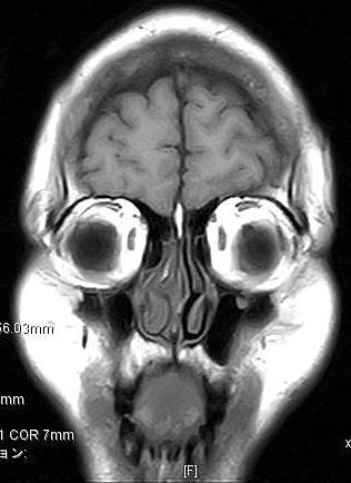 キクチメガネとは 一般の人気 最新記事を集めました はてな キクチメガネとは 一般の人気 最新記事を集めました はてな
