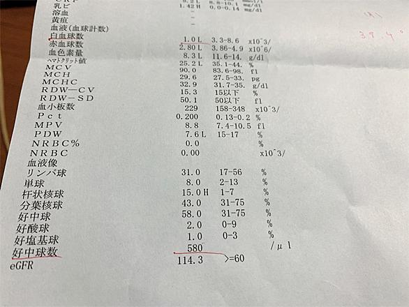 白血球とは サイエンスの人気 最新記事を集めました はてな