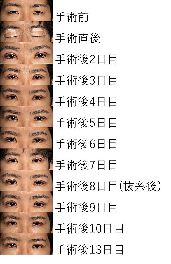 整形美人 とは テレビの人気 最新記事を集めました はてな 整形美人 とは テレビの人気 最新記事を集めました はてな