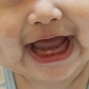 【７か月娘】赤ちゃん歯が生えるのいつ？上の歯から？下の歯から？