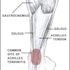 What Are The Causes And Indications Of  Achilles Tendon Rupture