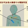 ECG-286：80才代女性です。静かにお暮らしです。心雑音有り。