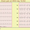 【ECG-406】70代女性。胸がもやもやするとの情報で、救急車での搬入です。