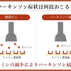 パーキンソン病を科学する