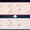 ECG-174：answer