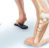 What Leads To Heel Pain And How To End It