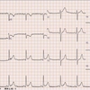 ECG-199：ANSWER