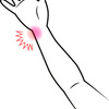 腱鞘炎に関する雑学