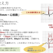 ファロー 四 徴 症 覚え 方