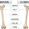 大腿骨の構造