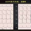 【ECG-291】10才男性；健診からの紹介です。