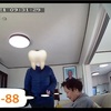 抜歯　1本目