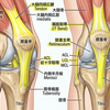 膝痛でみかけるのは膝の腱がはまるべき骨の筋道からズレて外れている状態。このときは腱をはめてからじゃないと大腿四頭筋等の筋トレをしたらきついことになるリスクも・・・。