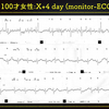 ECG-205：answer(2/2)