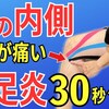 【ひざの内側が痛い】鵞足炎に効くマッサージ・ストレッチ法 ９選#055