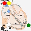 ホルター心電図の誘導法