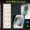 EC-255：answer