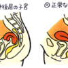 通水検査と3回目のAIH